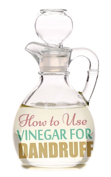 Vinegar for Dandruff