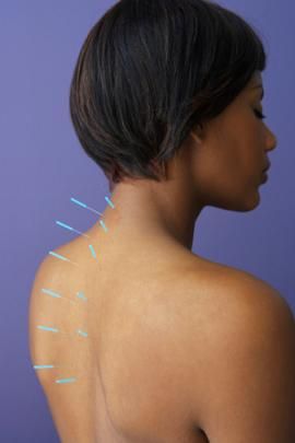 acupuncture for weight loss at home