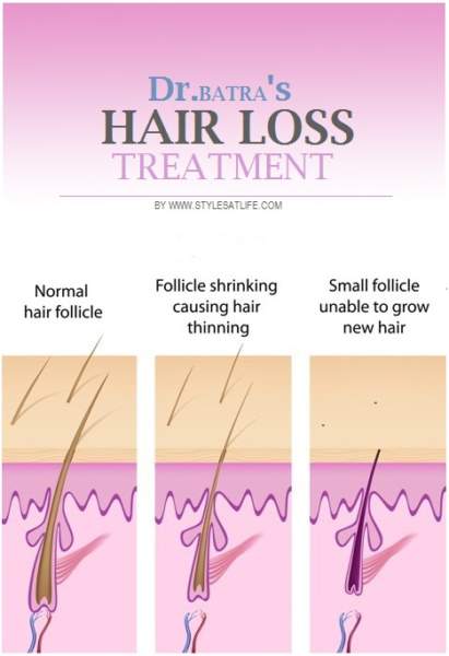 dr batras hair loss treatment