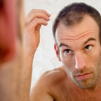 How Does DHT Cause Hair Loss