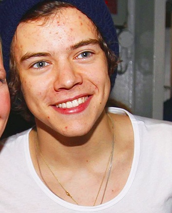 harry styles without makeup