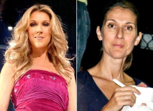 Celine Dion Without Makeup 4