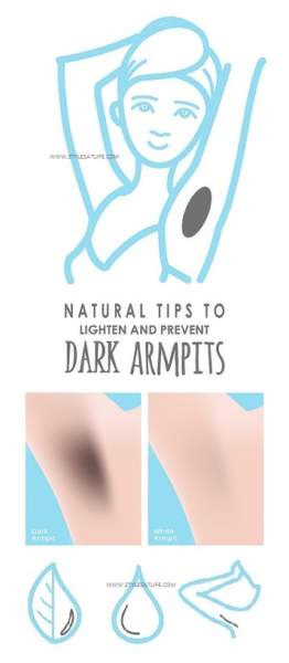 Natural Tips to Lighten and Prevent Dark Armpits