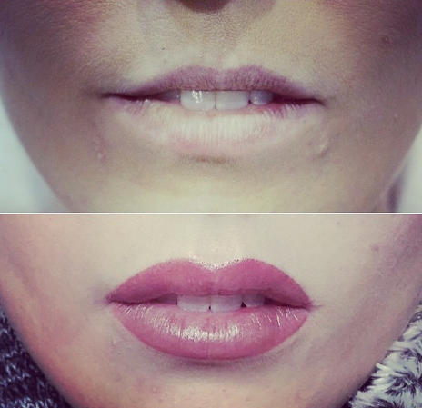 Semi Permanent Lip Liner  Blush  Medicare Cosmetics