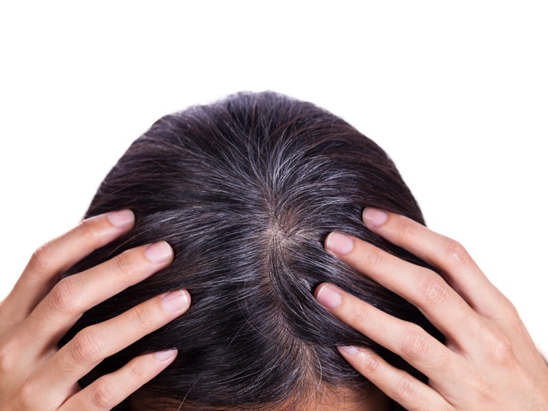 How to Stop Grey Hair Naturally  Causes  Home Remedies