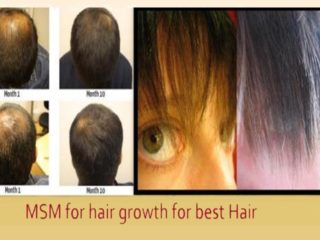Is MSM Good for Hair Growth?