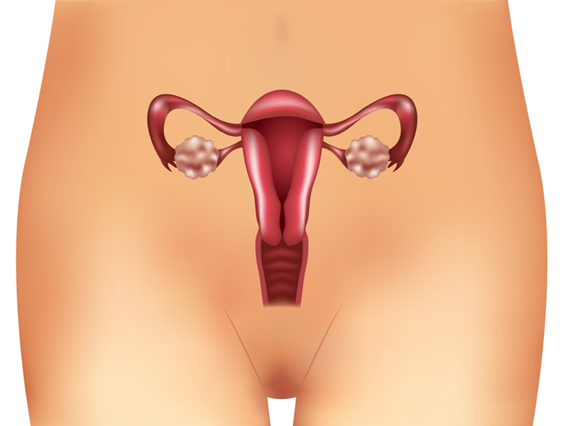 Ovarian Cyst Symptoms And Causes
