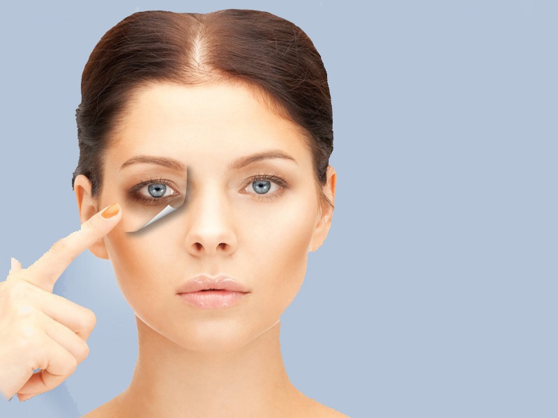 Ways To Remove Dark Circles Under Eyes