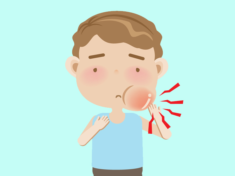 Mumps Causes Symptoms