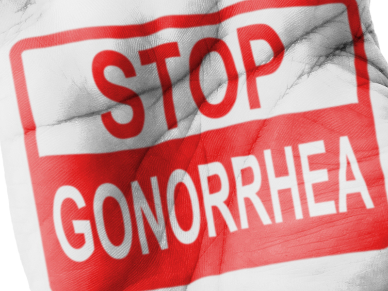 Gonorrhea Symptoms And Causes