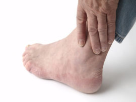 Quick And Natural Home Remedies To Treat Pain Caused By Gout