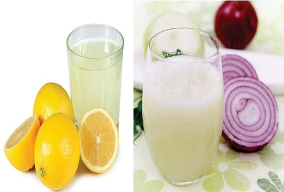 Lemon and Onion Juice for Hair