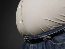 Symptoms And Causes Of Obesity