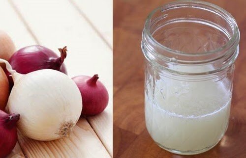 Onion Juice for Dandruff in Kids