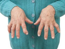 Most Common Symptoms And Causes of Rheumatoid Arthritis