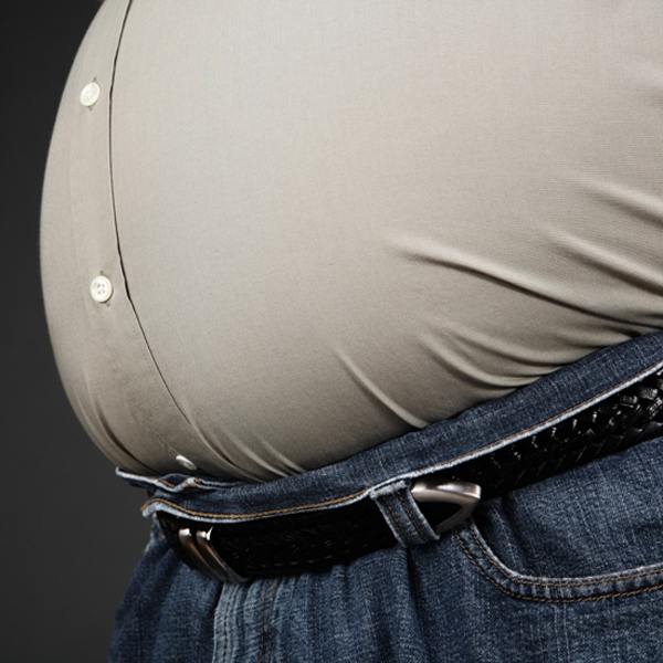 Obesity Causes and Symptoms