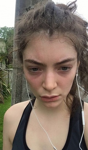 Pictures Of Lorde Without Makeup 4