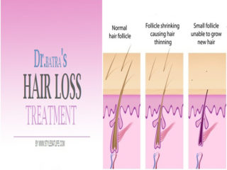 Dr Batra’s Hair Loss Treatment