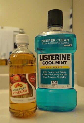 Listerine with Acv for dandruff