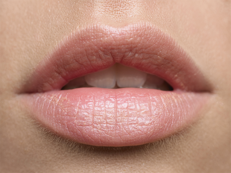 How Get Rid Of Chapped Lips