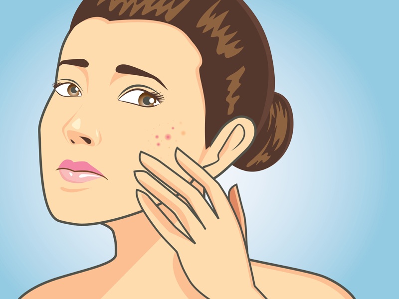 How To Remove Pimple Marks In 2 Days Naturally