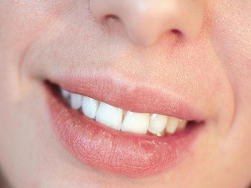 How To Remove Tan From Lips 2