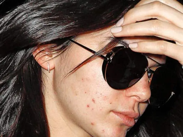 Kendall Jenner without Makeup