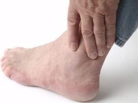 Identifying Gout: 9 Early Stage Symptoms