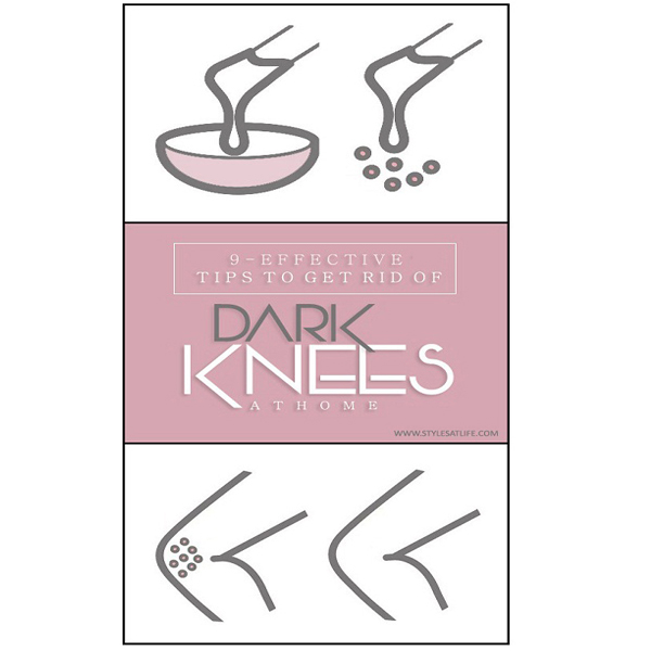 Tips to Get Rid of Dark Knees at Home