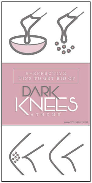 Tips to Get Rid of Dark Knees