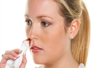 Nose Bleeding During Pregnancy Causes and Remedies