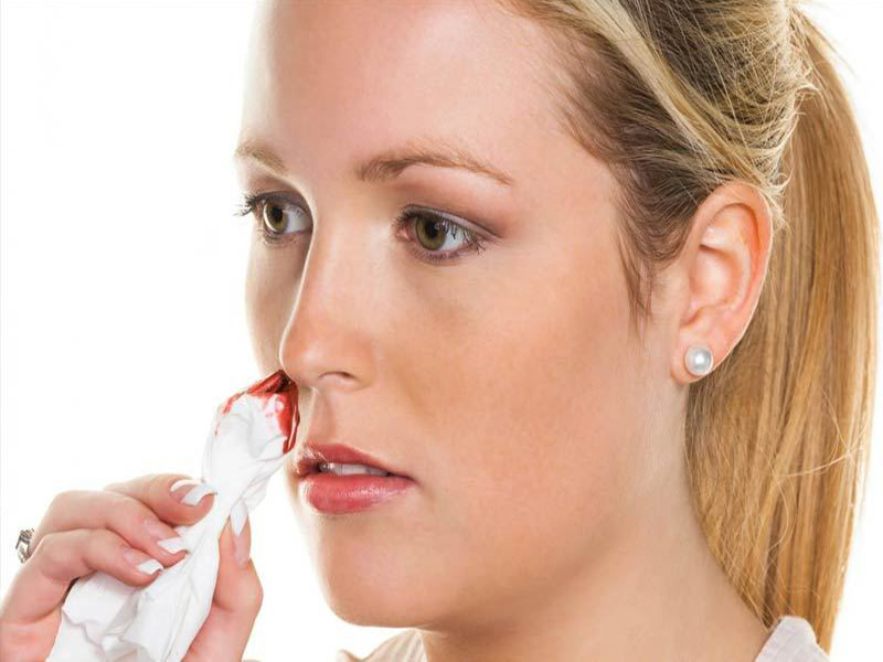 Nose Bleeding During Pregnancy