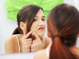 How to Avoid Pimples Causes and Tips for Prevention!