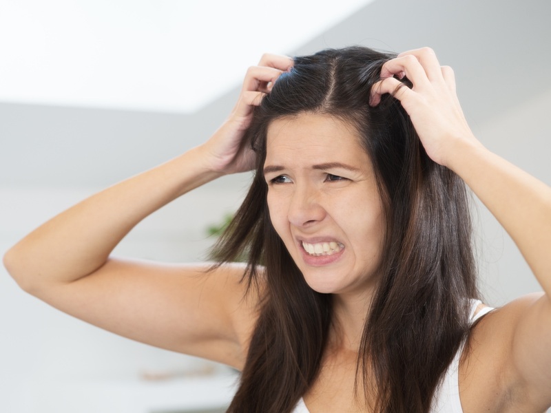 How To Get Rid Of Dandruff Fast