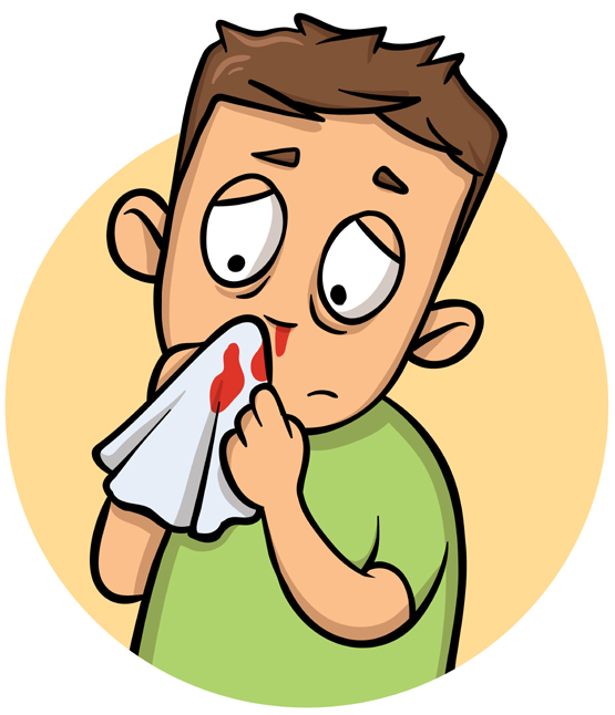 What Causes Nose Bleeding