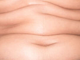 How To Reduce Stomach Fat?