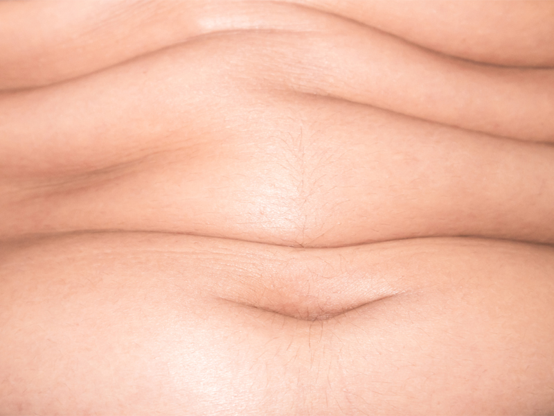 How To Lose Stomach Fat Healthily