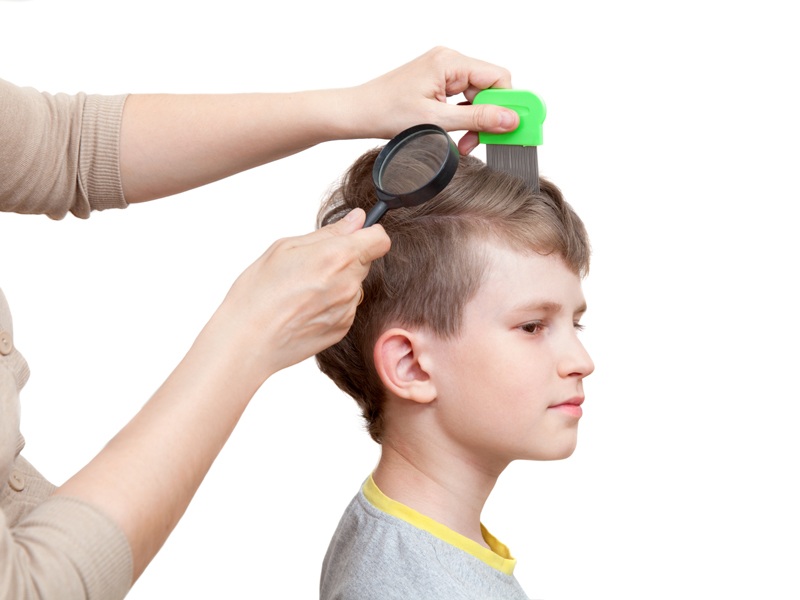 10 Safe Home Remedies To Treat Dandruff In Kids Styles