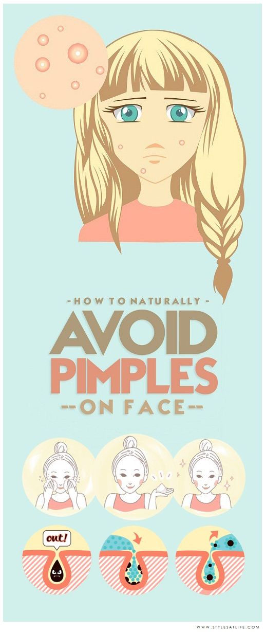 How To Avoid Pimples Causes And Tips