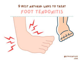 9 Best Natural Ways to Treat Foot Tendonitis at Home