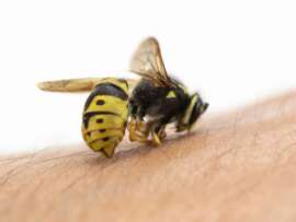 10 Best Home Remedies to Treat Honeybee Stings