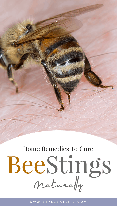 home remedies for bee sting