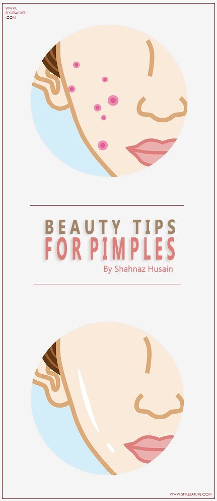 Best Shahnaz Hussain Beauty Tips For Pimples