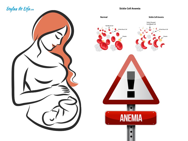 Understanding Anemia In Pregnancy