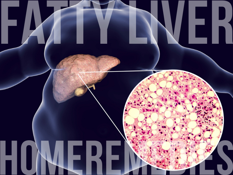 home remedies for fatty liver