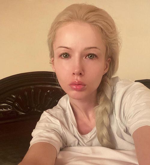 Valeria Lukyanova Without Makeup 10