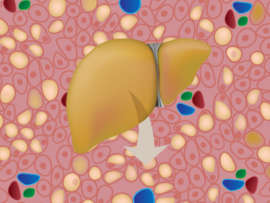 Fatty Liver: Symptoms, Causes and Effects (NAFLD & AFLD)