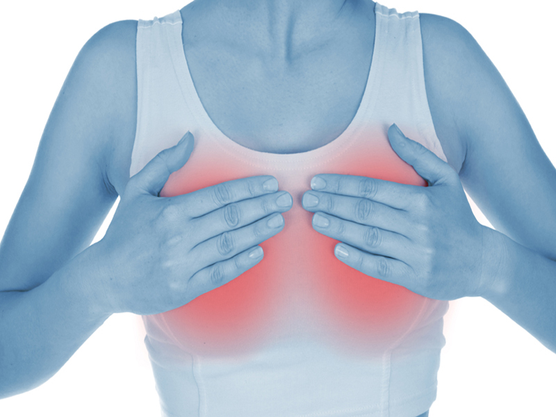Home Remedies To Treat Sore Breasts