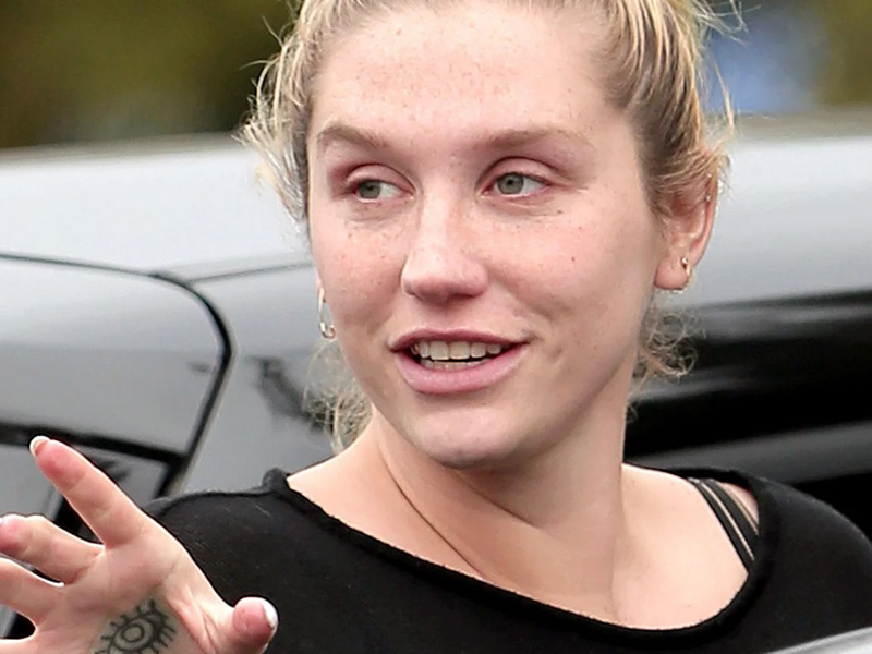 Kesha With And Without Makeup