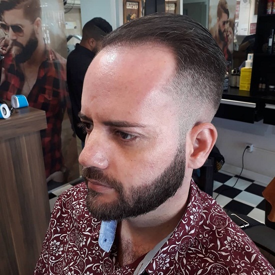 male pattern baldness hairstyles